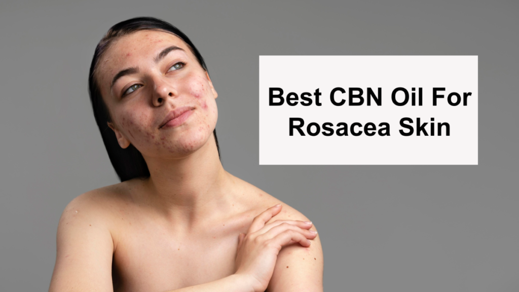 CBN oil for rosacea skin